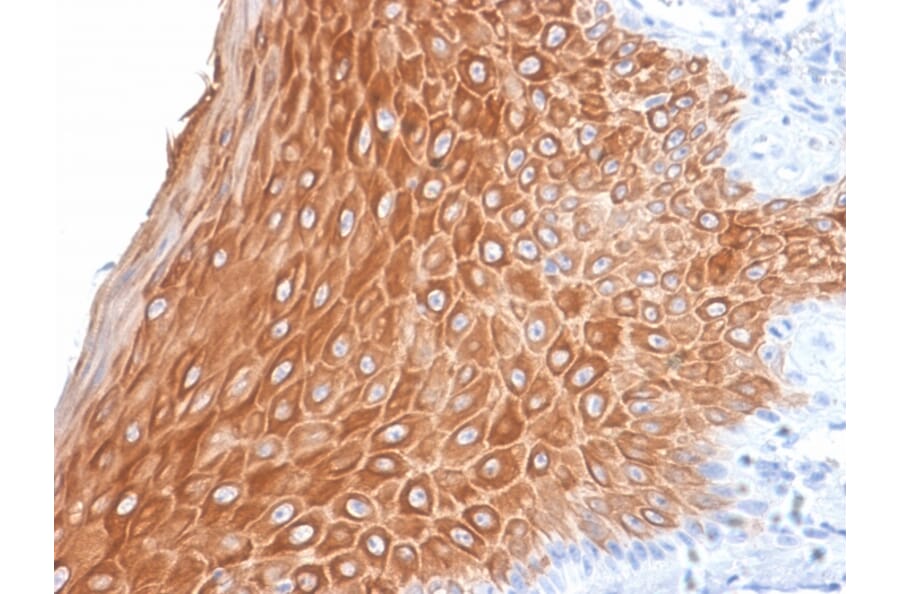 Immunohistochemistry - Anti-Cytokeratin 16 Antibody [KRT16/2043R] (A249187) - Antibodies.com