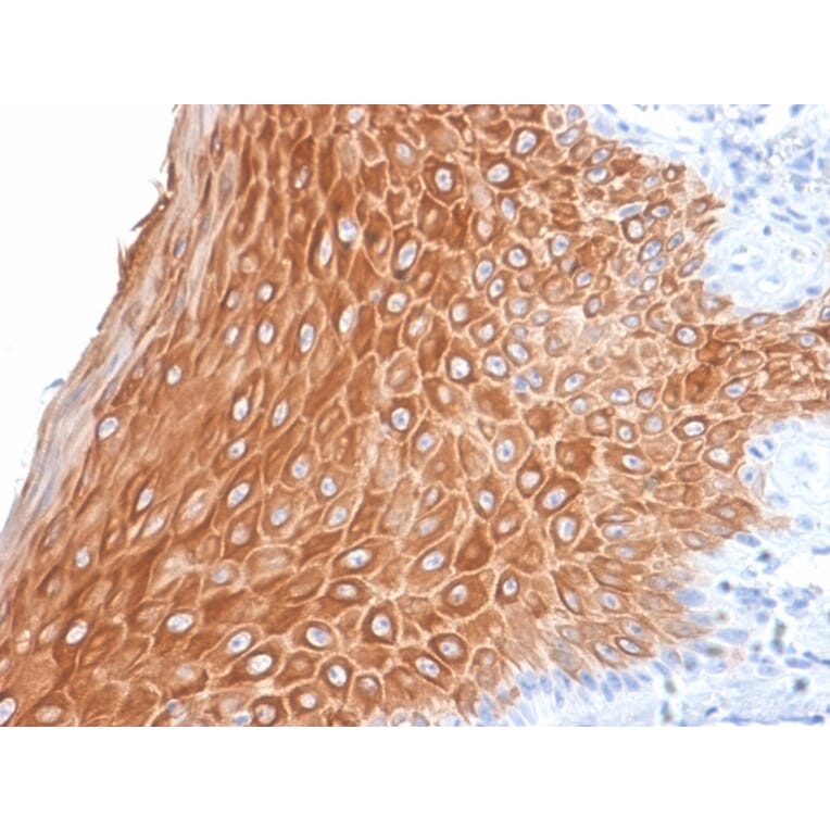 Immunohistochemistry - Anti-Cytokeratin 16 Antibody [KRT16/2043R] (A249187) - Antibodies.com