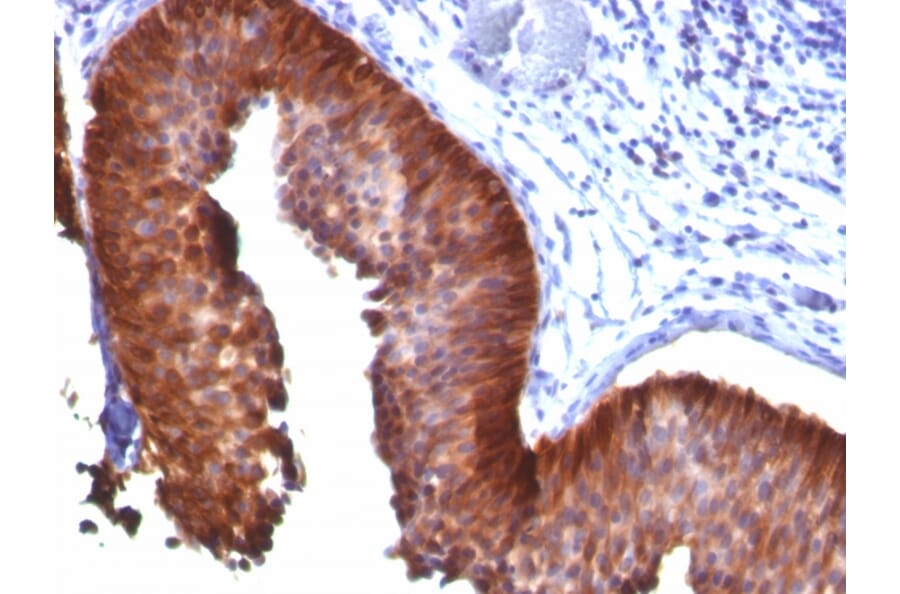 Immunohistochemistry - Anti-Cytokeratin 17 Antibody [E3] (A249188) - Antibodies.com