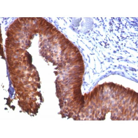 Immunohistochemistry - Anti-Cytokeratin 17 Antibody [E3] (A249188) - Antibodies.com