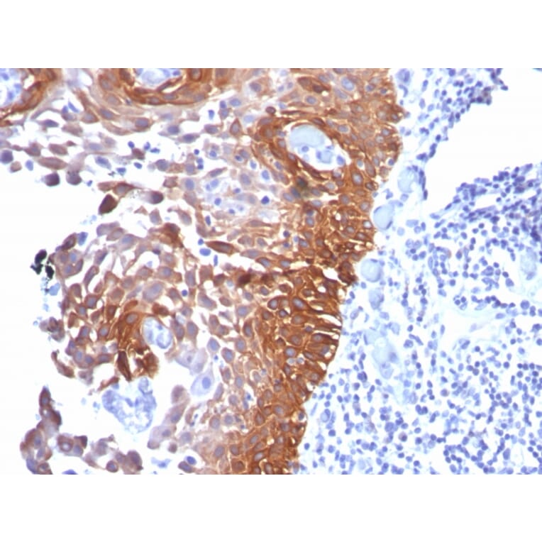 Immunohistochemistry - Anti-Cytokeratin 17 Antibody [E3] (A249189) - Antibodies.com