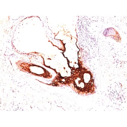 Immunohistochemistry - Anti-Cytokeratin 17 Antibody [SPM560] (A249190) - Antibodies.com