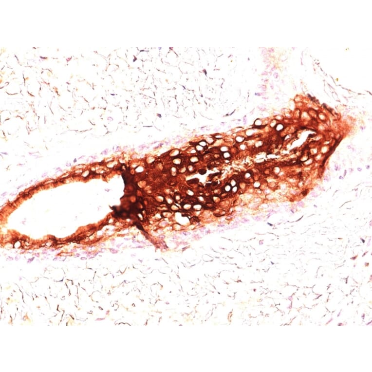 Immunohistochemistry - Anti-Cytokeratin 17 Antibody [SPM560] (A249190) - Antibodies.com