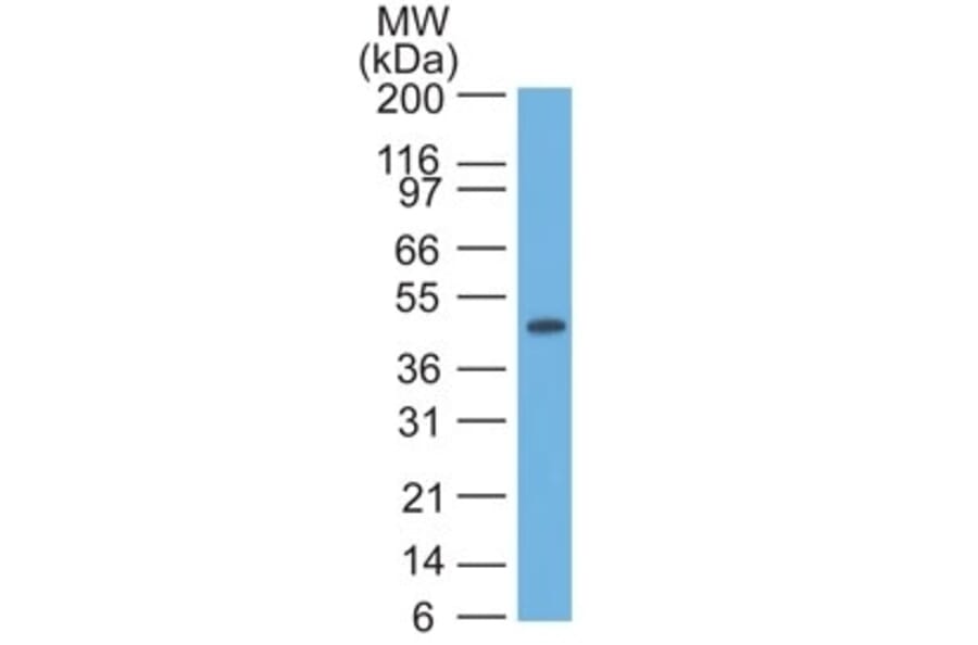Western Blot - Anti-Cytokeratin 17 Antibody [SPM560] (A249190) - Antibodies.com