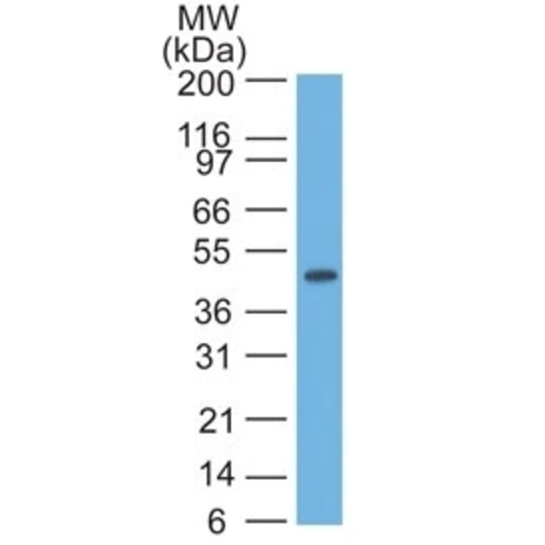 Western Blot - Anti-Cytokeratin 17 Antibody [SPM560] (A249190) - Antibodies.com