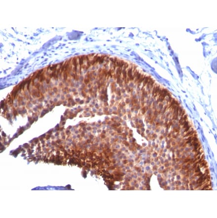Immunohistochemistry - Anti-Cytokeratin 17 Antibody [KRT17/778] (A249190) - Antibodies.com