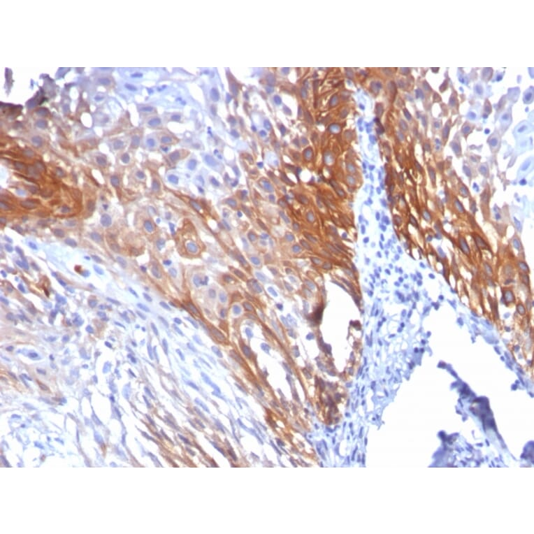 Immunohistochemistry - Anti-Cytokeratin 17 Antibody [KRT17/778] (A249191) - Antibodies.com