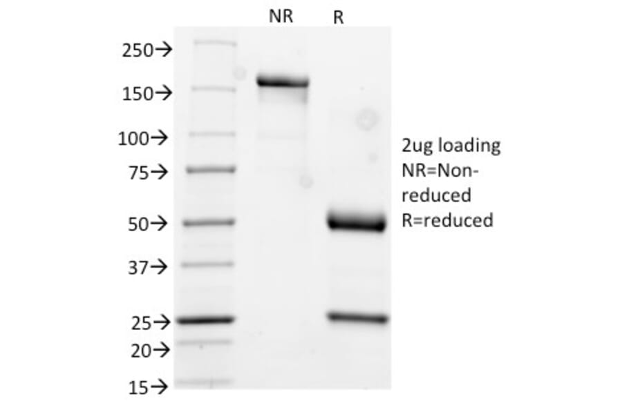 SDS-PAGE - Anti-Cytokeratin 17 Antibody [KRT17/778] (A249191) - Antibodies.com