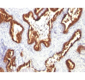 Immunohistochemistry - Anti-Cytokeratin 18 Antibody [KRT18/1190] (A249192) - Antibodies.com