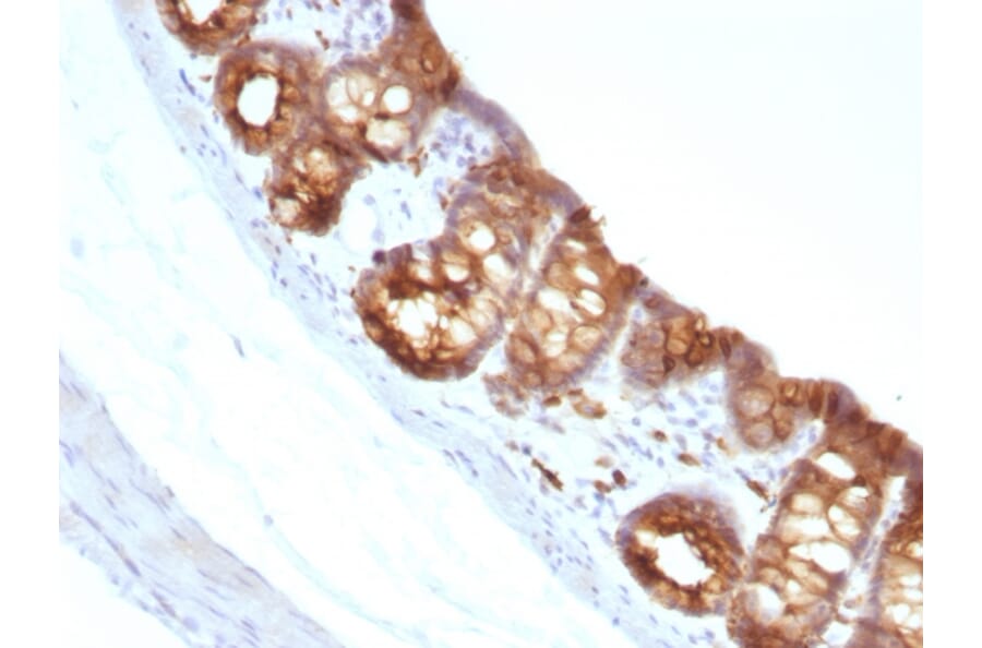 Immunohistochemistry - Anti-Cytokeratin 18 Antibody [KRT18/1190] (A249192) - Antibodies.com