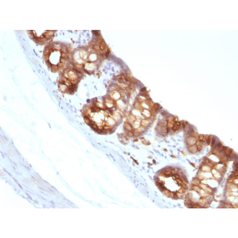 Immunohistochemistry - Anti-Cytokeratin 18 Antibody [KRT18/1190] (A249192) - Antibodies.com