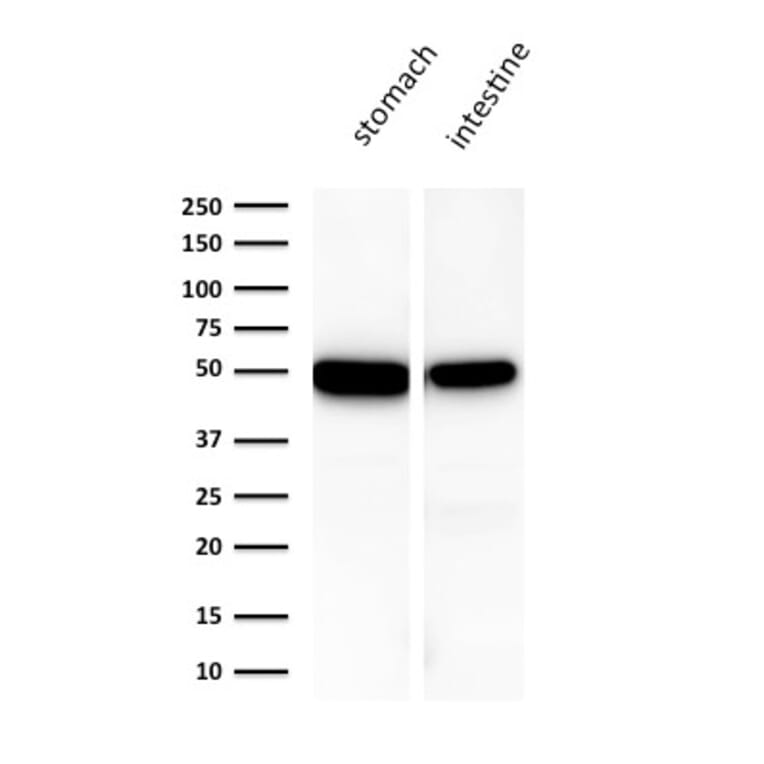 Western Blot - Anti-Cytokeratin 18 Antibody [KRT18/1190] (A249192) - Antibodies.com