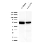 Western Blot - Anti-Cytokeratin 18 Antibody [KRT18/1190] (A249192) - Antibodies.com