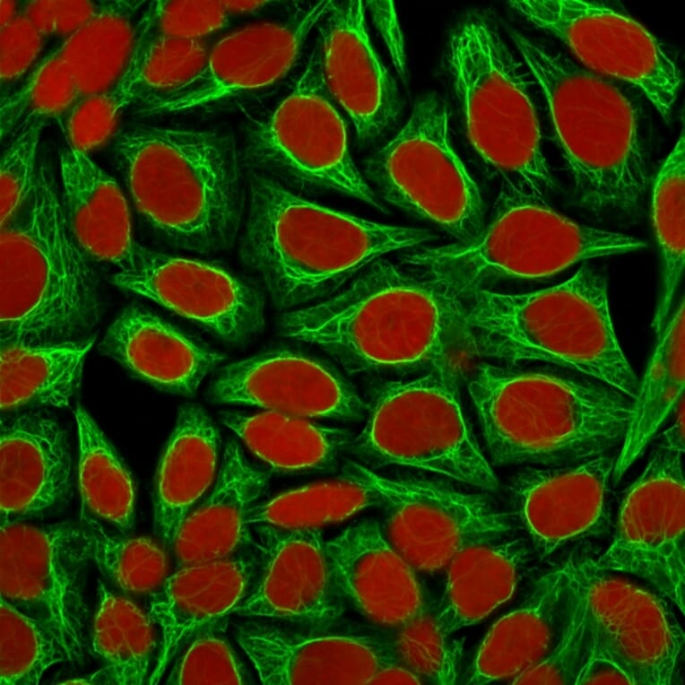 Immunofluorescence - Anti-Cytokeratin 18 Antibody [KRT18/1190] (A249191) - Antibodies.com