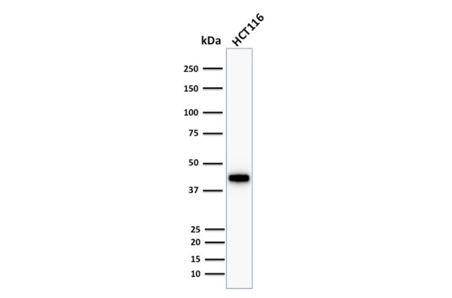 Western Blot - Anti-Cytokeratin 18 Antibody [KRT18/1190] (A249192) - Antibodies.com