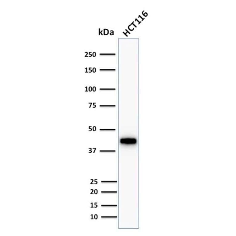 Western Blot - Anti-Cytokeratin 18 Antibody [KRT18/1190] (A249192) - Antibodies.com