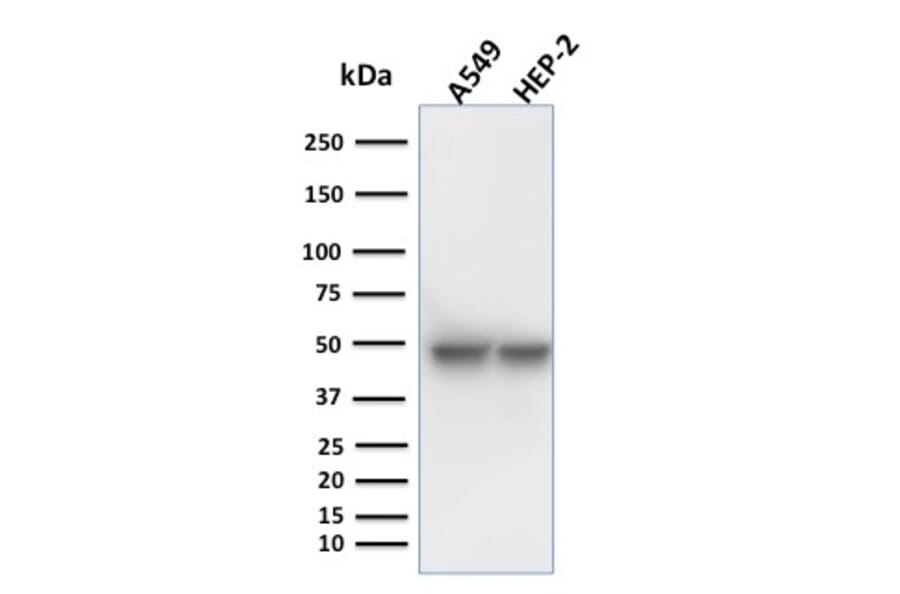 Western Blot - Anti-Cytokeratin 18 Antibody [KRT18/1190] (A249192) - Antibodies.com