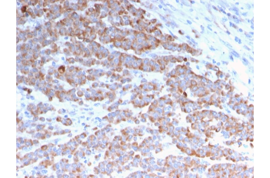 Immunohistochemistry - Anti-Cytokeratin 18 Antibody [rKRT18/1190] (A249193) - Antibodies.com
