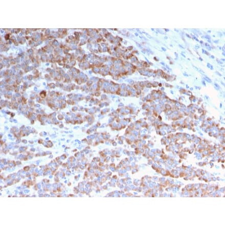 Immunohistochemistry - Anti-Cytokeratin 18 Antibody [rKRT18/1190] (A249193) - Antibodies.com