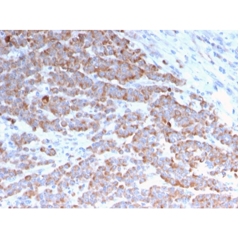 Immunohistochemistry - Anti-Cytokeratin 18 Antibody [rKRT18/1190] (A249193) - Antibodies.com