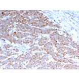 Immunohistochemistry - Anti-Cytokeratin 18 Antibody [rKRT18/1190] (A249193) - Antibodies.com