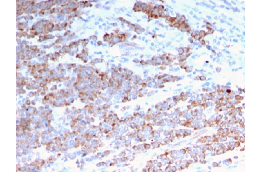 Immunohistochemistry - Anti-Cytokeratin 18 Antibody [rKRT18/1190] (A249192) - Antibodies.com
