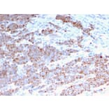 Immunohistochemistry - Anti-Cytokeratin 18 Antibody [rKRT18/1190] (A249192) - Antibodies.com