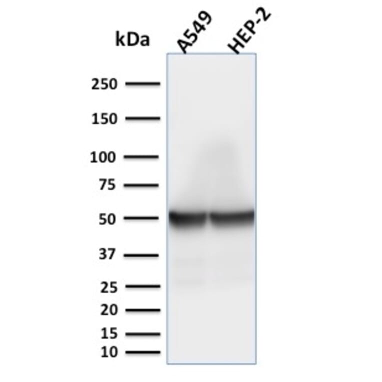 Western Blot - Anti-Cytokeratin 18 Antibody [rKRT18/1190] (A249193) - Antibodies.com