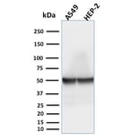 Western Blot - Anti-Cytokeratin 18 Antibody [rKRT18/1190] (A249193) - Antibodies.com