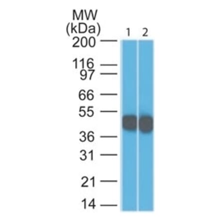 Western Blot - Anti-Cytokeratin 18 Antibody [DC10] (A249194) - Antibodies.com