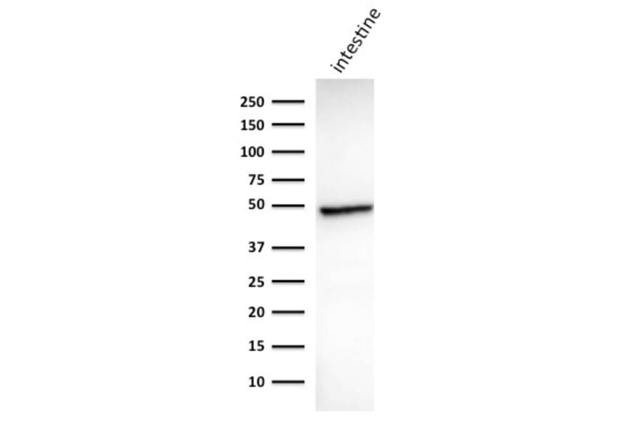 Western Blot - Anti-Cytokeratin 18 Antibody [DC10] (A249194) - Antibodies.com