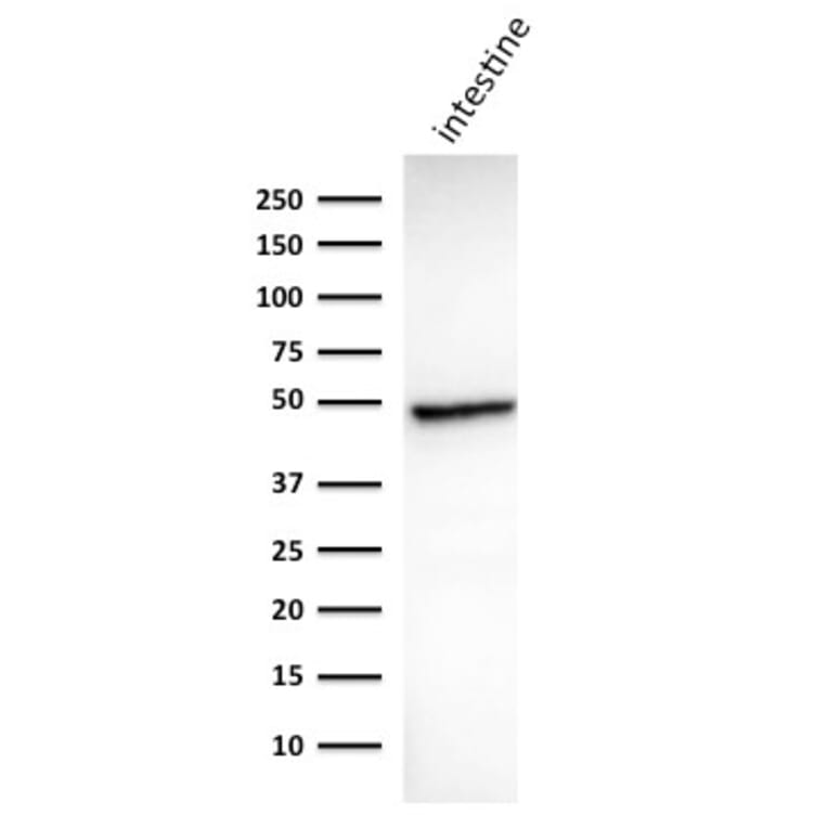 Western Blot - Anti-Cytokeratin 18 Antibody [DC10] (A249194) - Antibodies.com