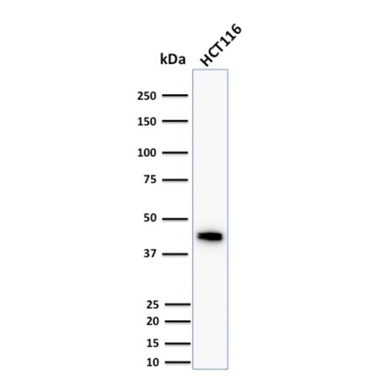 Western Blot - Anti-Cytokeratin 18 Antibody [DC10] (A249194) - Antibodies.com