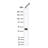 Western Blot - Anti-Cytokeratin 18 Antibody [DC10] (A249194) - Antibodies.com