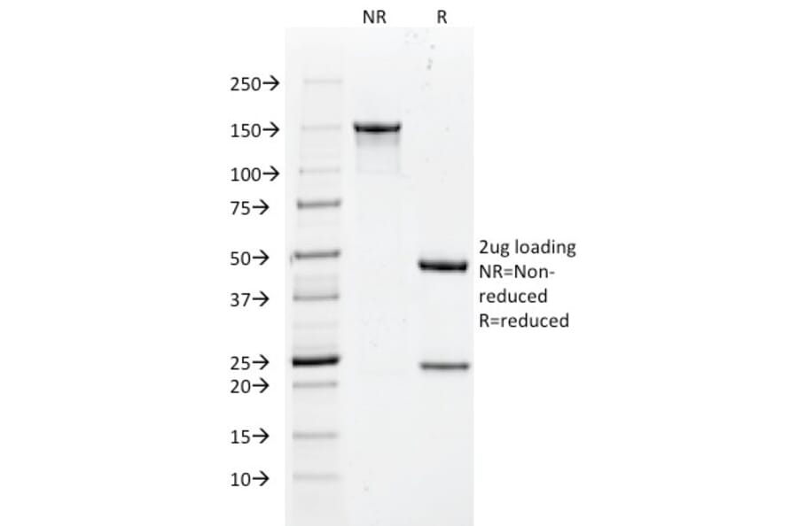 SDS-PAGE - Anti-Cytokeratin 18 Antibody [DC10] (A249194) - Antibodies.com
