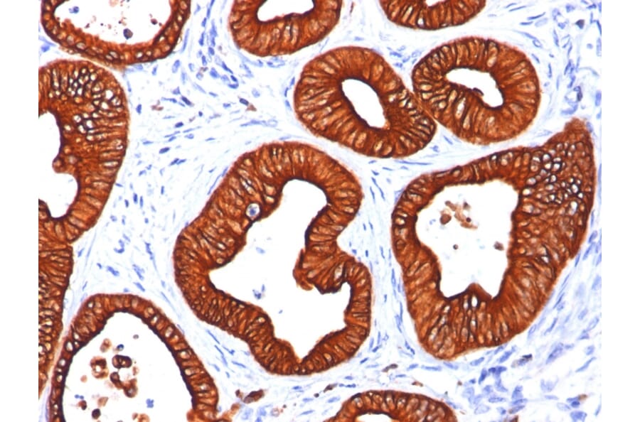 Immunohistochemistry - Anti-Cytokeratin 18 Antibody [SPM265] (A249195) - Antibodies.com