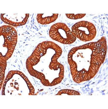 Immunohistochemistry - Anti-Cytokeratin 18 Antibody [SPM265] (A249195) - Antibodies.com