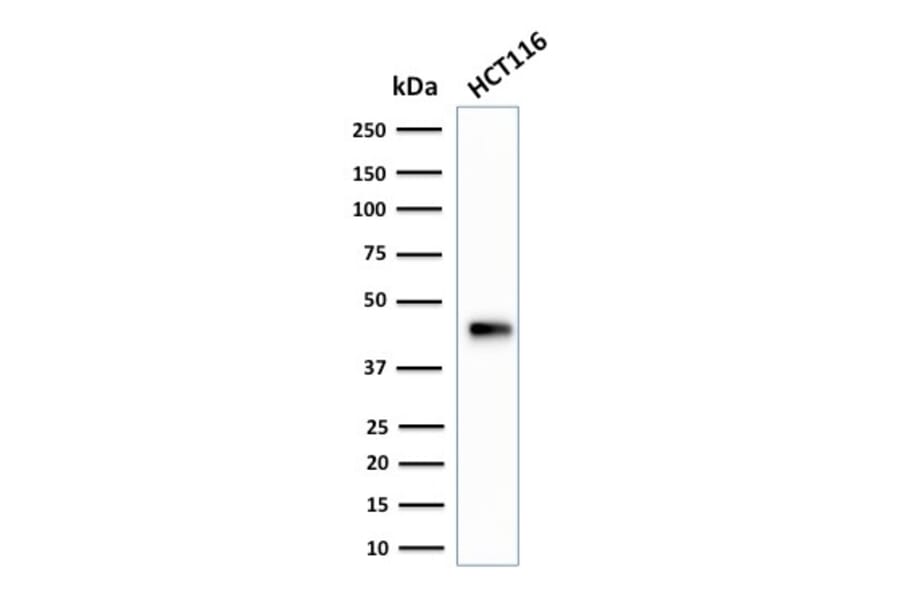 Western Blot - Anti-Cytokeratin 18 Antibody [SPM265] (A249195) - Antibodies.com