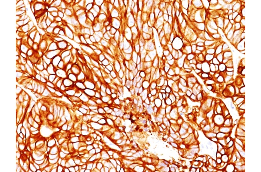 Immunohistochemistry - Anti-Cytokeratin 18 Antibody [DA7] (A249196) - Antibodies.com