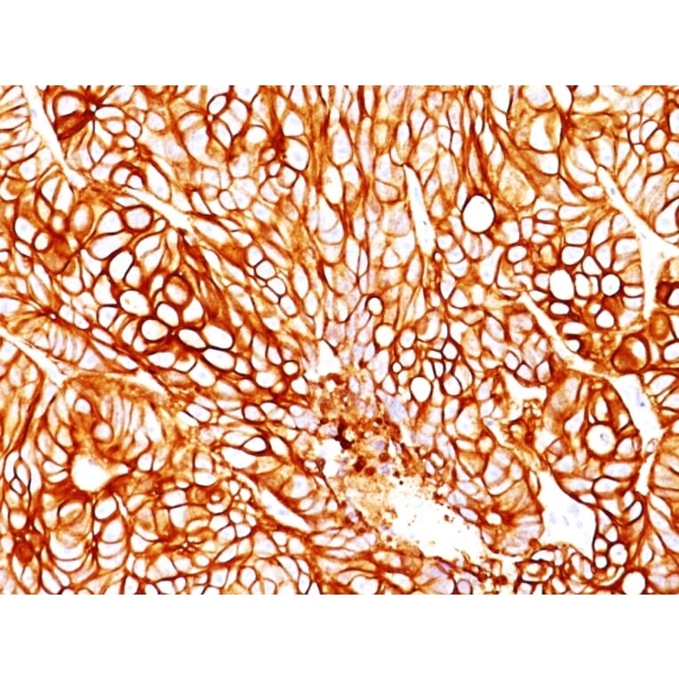 Immunohistochemistry - Anti-Cytokeratin 18 Antibody [DA7] (A249196) - Antibodies.com