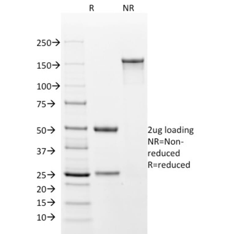 SDS-PAGE - Anti-Cytokeratin 18 Antibody [DA7] (A249196) - Antibodies.com