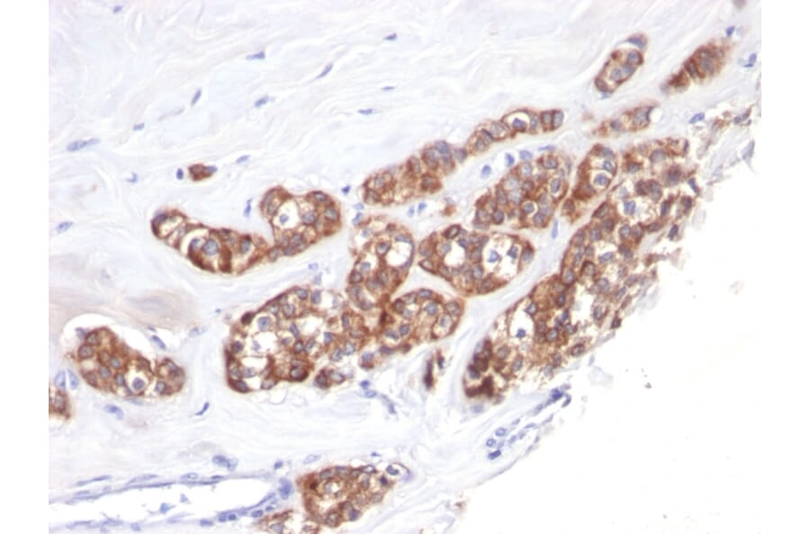 Immunohistochemistry - Anti-Cytokeratin 18 Antibody [SPM510] (A249197) - Antibodies.com
