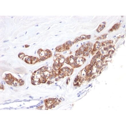 Immunohistochemistry - Anti-Cytokeratin 18 Antibody [SPM510] (A249197) - Antibodies.com