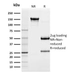 SDS-PAGE - Anti-Cytokeratin 18 Antibody [SPM510] (A249197) - Antibodies.com