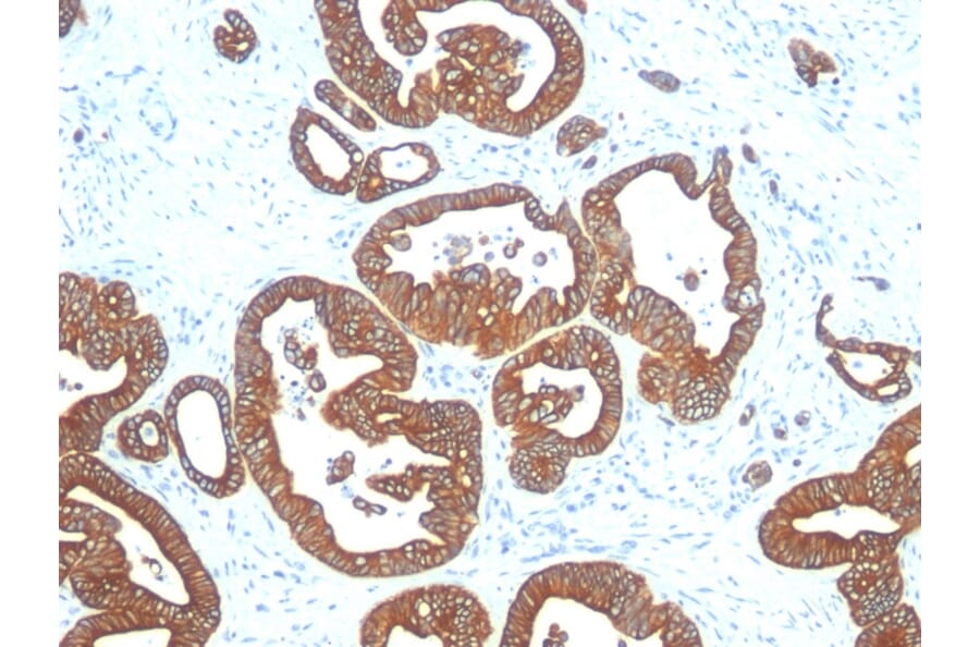 Immunohistochemistry - Anti-Cytokeratin 18 Antibody [DE-K18] (A249198) - Antibodies.com