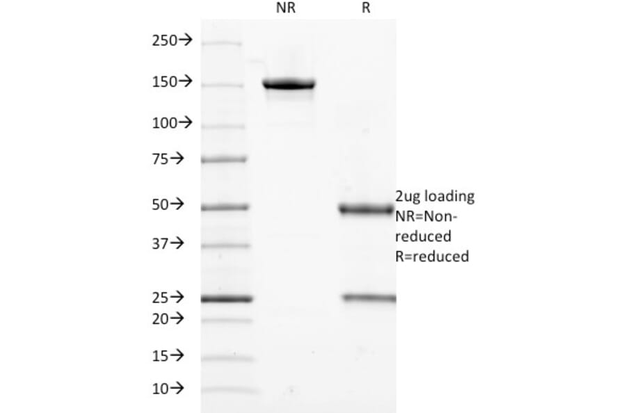 SDS-PAGE - Anti-Cytokeratin 18 Antibody [DE-K18] (A249198) - Antibodies.com