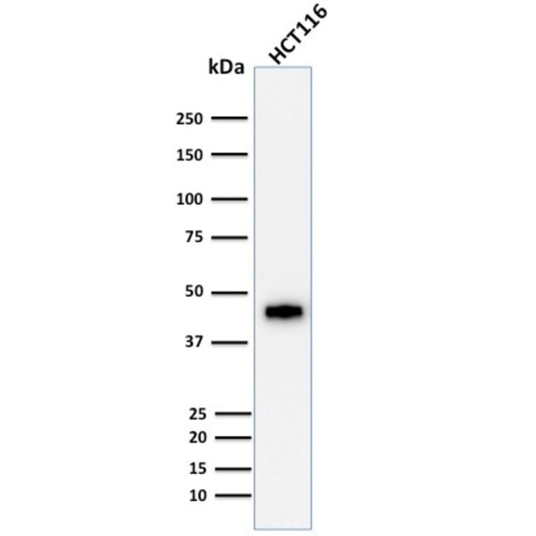 Western Blot - Anti-Cytokeratin 18 Antibody [DE-K18] (A249198) - Antibodies.com