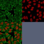 Immunofluorescence - Anti-Cytokeratin 18 Antibody [DE-K18] (A249198) - Antibodies.com