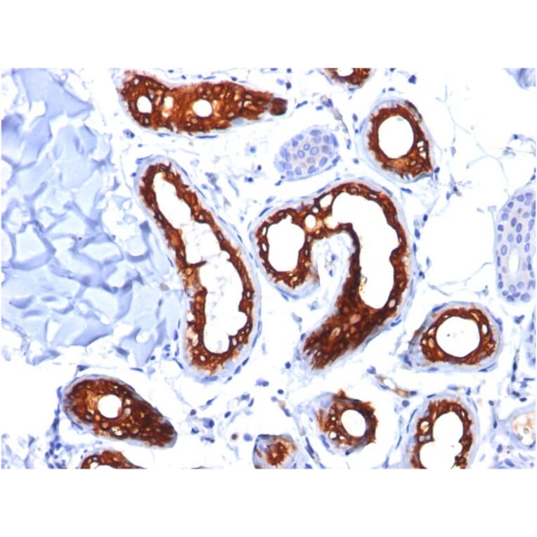 Immunohistochemistry - Anti-Cytokeratin 18 Antibody [KRT18/834] (A249199) - Antibodies.com