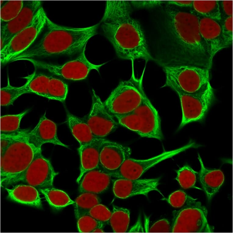 Immunofluorescence - Anti-Cytokeratin 18 Antibody [KRT18/834] (A249199) - Antibodies.com